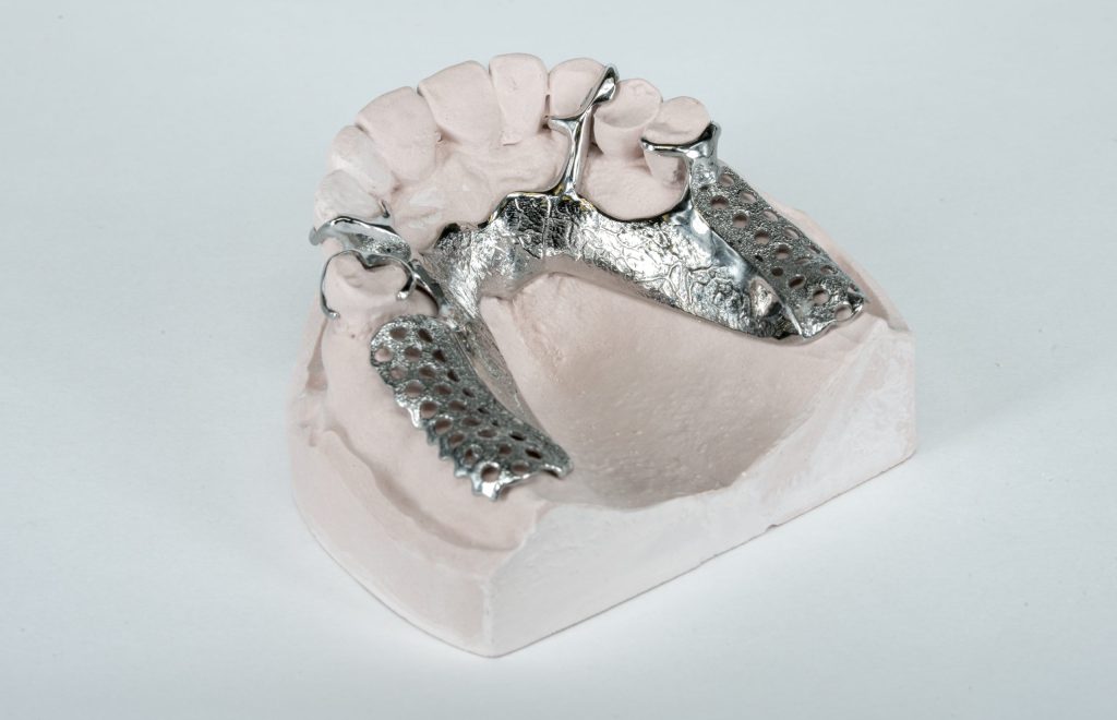 Gedeeltelijke prothese in Veenendaal