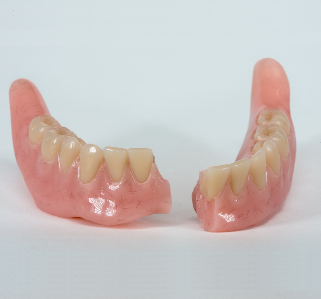 Reparatie van een kunstgebit bij tandprotheticus in Veenendaal